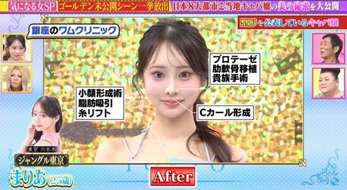 マツコ「整形女子が綺麗だと思えないの。美の基準が違いすぎて、街を歩いてる港区女子の顔が怖くて最近」