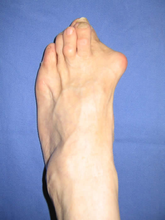 108_0898