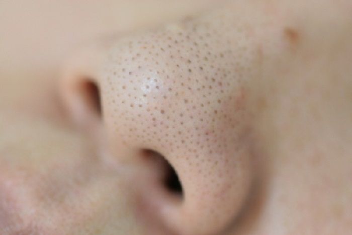 閲覧注意 鼻の脂って押すとニュルニュル出るよね あれってさ ハムスター速報b 閲覧注意 鼻の脂って押すとニュルニュル出るよね あれってさ ハムスター速報b