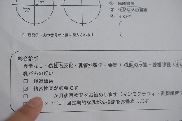 乳がん検診で要精密検査に 細胞診 をすることに Happy Go Lucky 心地いい暮らしのコツ Powered By ライブドアブログ