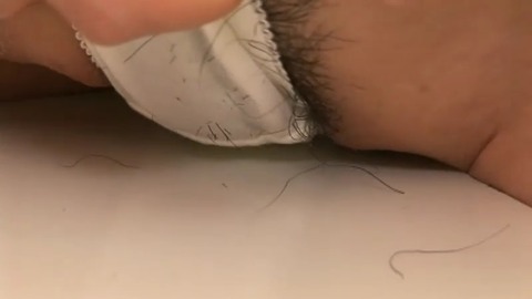000990944