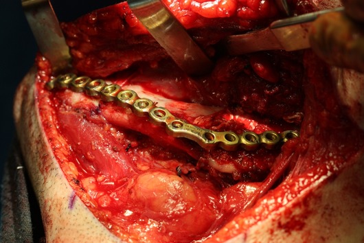 surgery005-1024x683