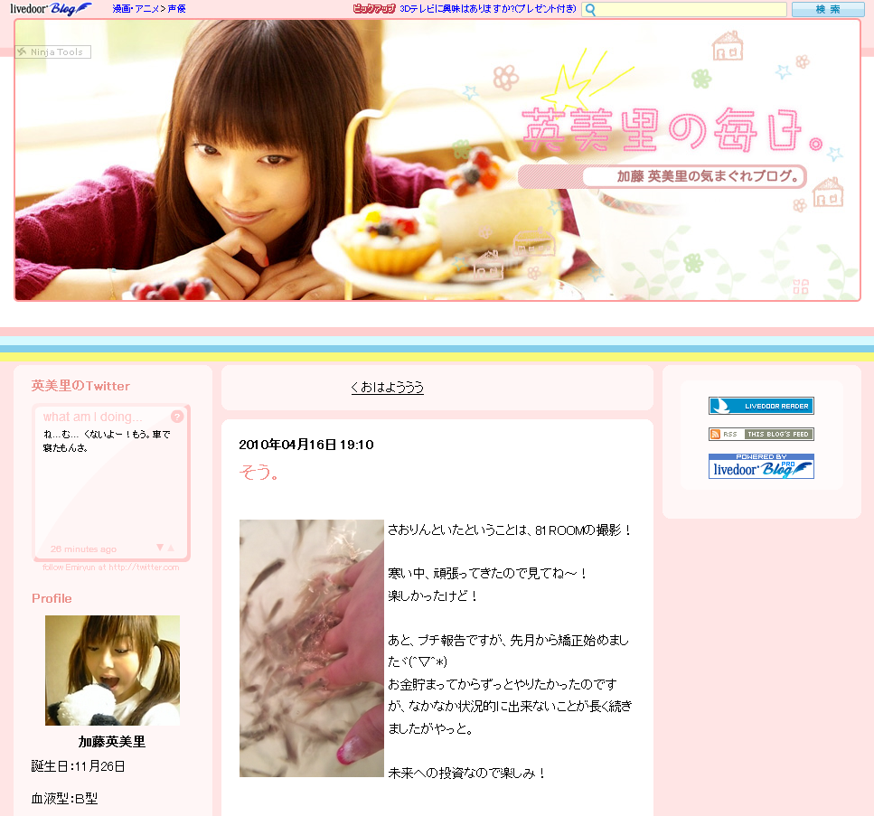 超速報 声優の加藤英美里さんが遂に歯の矯正を開始 ２のまとめｒ