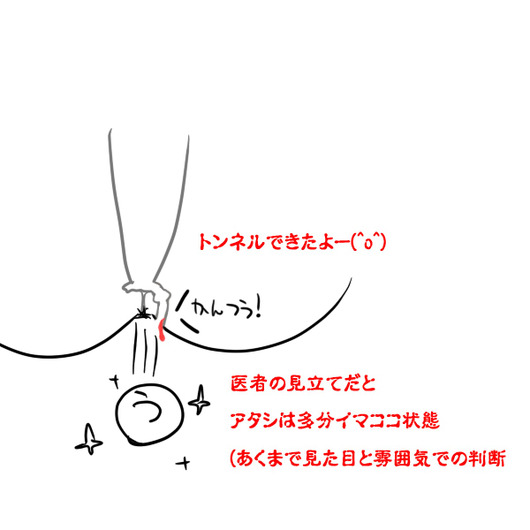 sukima005630