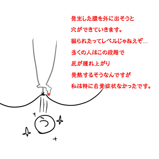 sukima005629