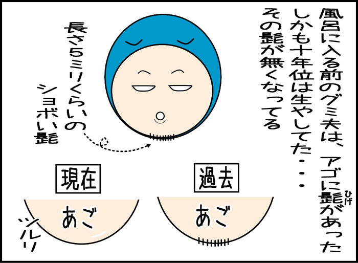 風呂に入る前のグミ夫には十年位生やしてた顎鬚があった。その髭が無くなっている