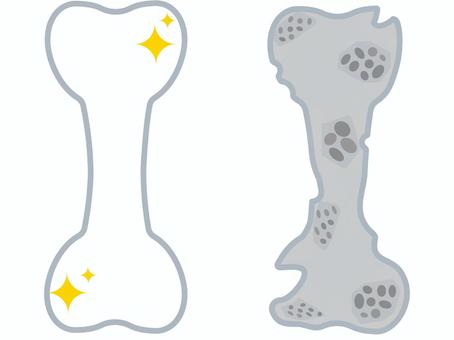 kotusoshoushou