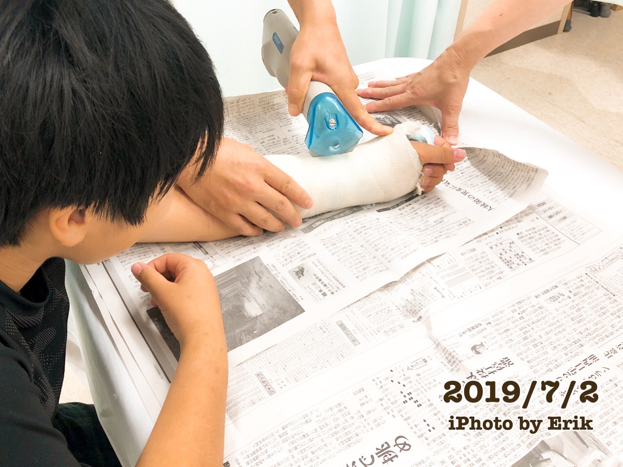 小学生男子の骨折はこんな治療経過 私の骨折話 骨折 10歳 写真で魅力発掘 暮らしのフォトダイアリー Powered By ライブドアブログ 小学生男子の骨折はこんな治療経過 私の骨折話 骨折 10歳 写真で魅力発掘 暮らしのフォトダイアリー Powered By ライブドアブログ