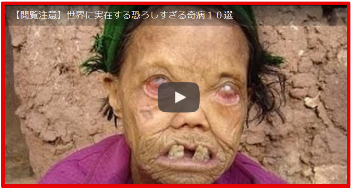 超閲覧注意 世界に実在する恐ろしすぎる奇病１０選 Happykoaraのblog