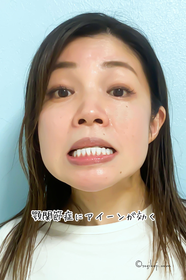 エラボトックス9