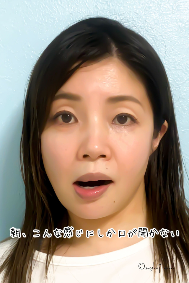 エラボトックス8
