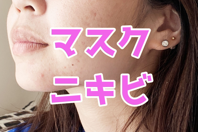 マスクニキビ1