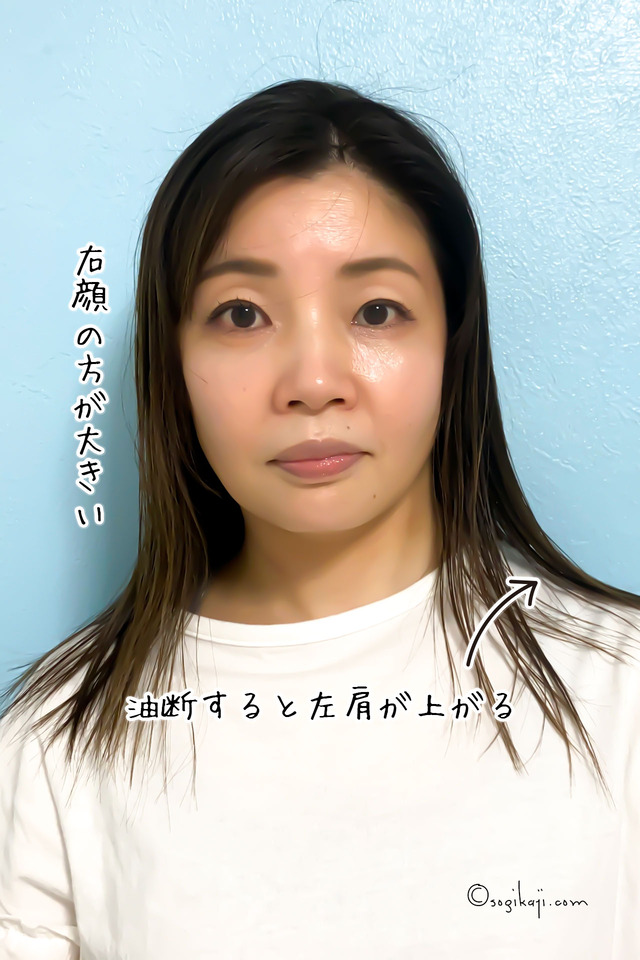 エラボトックス6