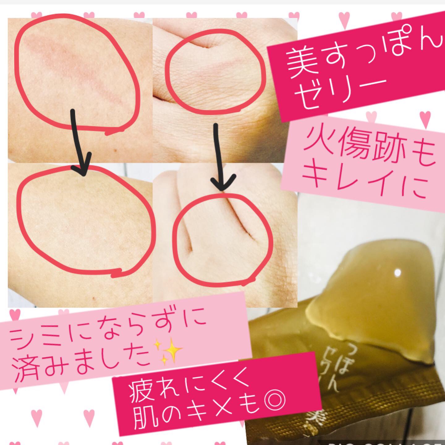美すっぽんゼリーを飲んでみたら シミになりやすかったお肌が 好きなことだけする生活日記 美すっぽんゼリーを飲んでみたら シミになりやすかったお肌が 好きなことだけする生活日記