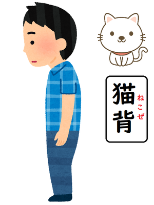 猫背