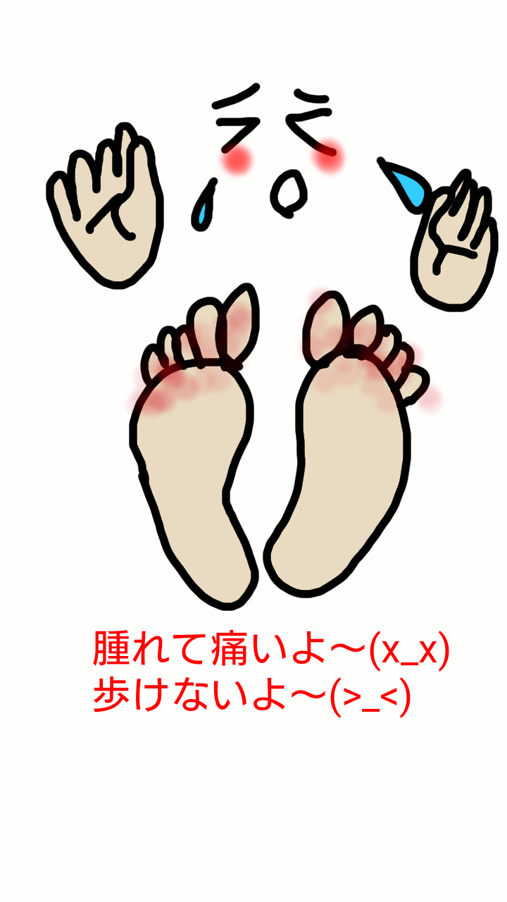 娘 両足にしもやけ 笑う門には福来る はるりくママの 気まま日記 娘 両足にしもやけ 笑う門には福来る はるりくママの 気まま日記