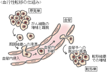 がんはなぜ、どのように転移するのか