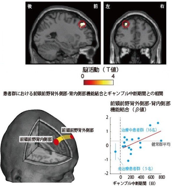 引用画像