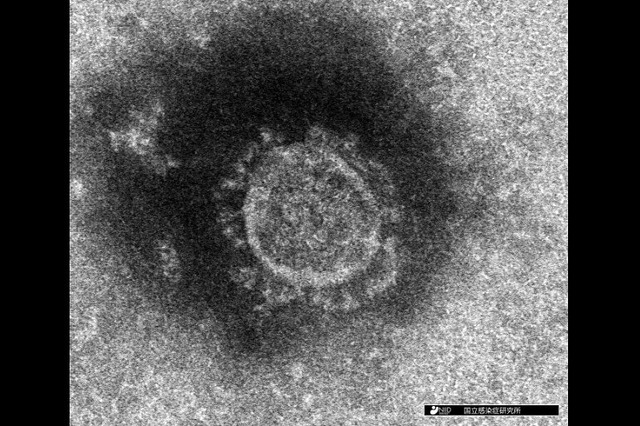 img2_file5ea223185a38d