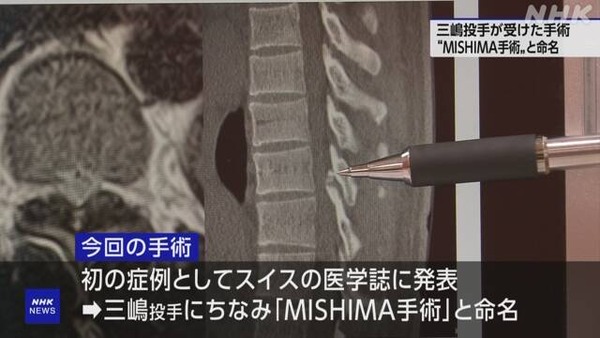 DeNA三嶋投手が受けた国指定難病の手術「MISHIMA手術」と命名