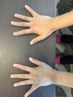 手の甲