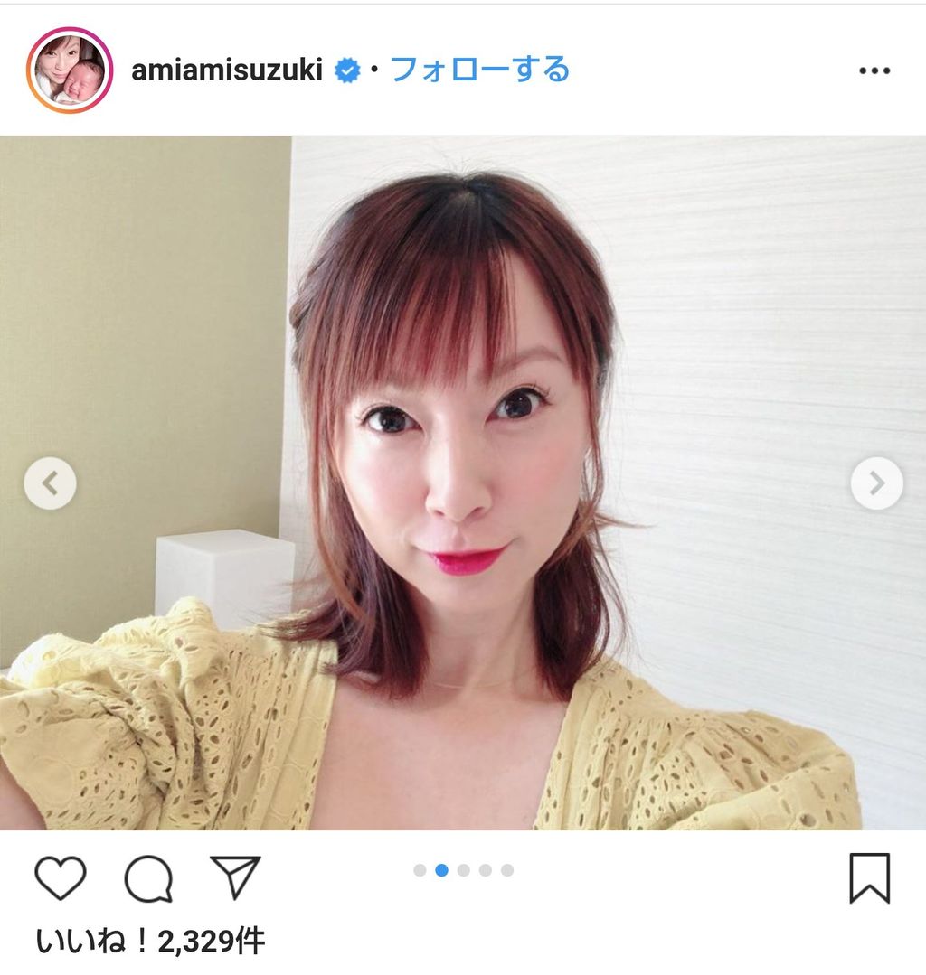 悲報 最新の鈴木亜美さん 目頭切開のせいで日本人離れした顔に はやまと