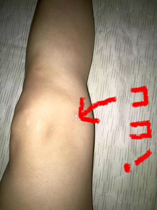 膝の痛みにエンビシン お稽古日誌