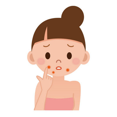 ニキビ(イラスト)