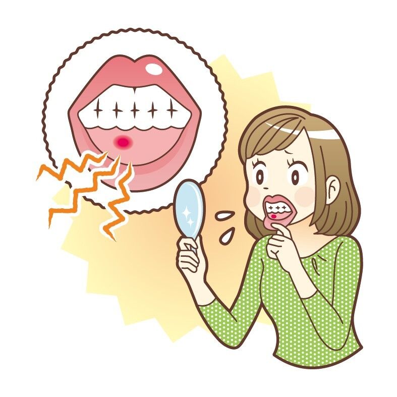 口内炎できたんやが速攻で治す方法ある 気になる健美まとめちゃんねる 口内炎できたんやが速攻で治す方法ある 気になる健美まとめちゃんねる