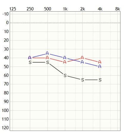 90fg
