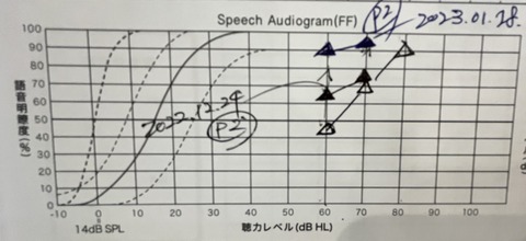 260120_52063_明瞭度測定