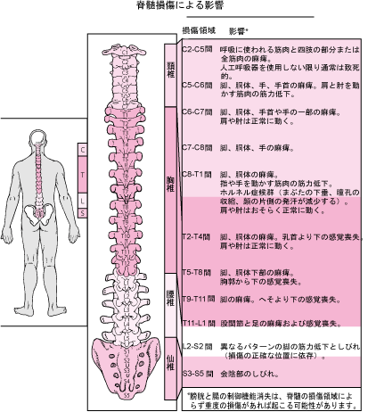 左半身に痺れがでました　-脳梗塞？脳出血？運動不足？-