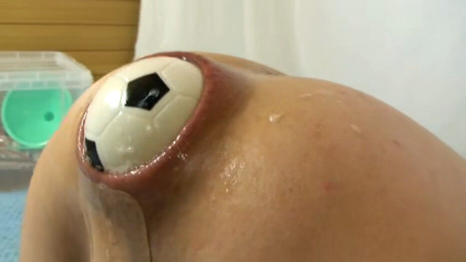 ◆【衝撃映像】アナル裂傷!拡張済みのケツ穴にサッカーボール丸呑みしたド変態妻の肛門接写!! 変態の宴Ⅱ