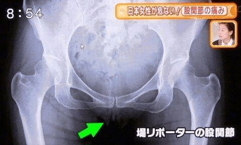 ◆テレビで流れてしまった回避できないハプニング【まとめ】パンチラ・胸チラ・放送事故Vol.2 変態の宴Ⅱ