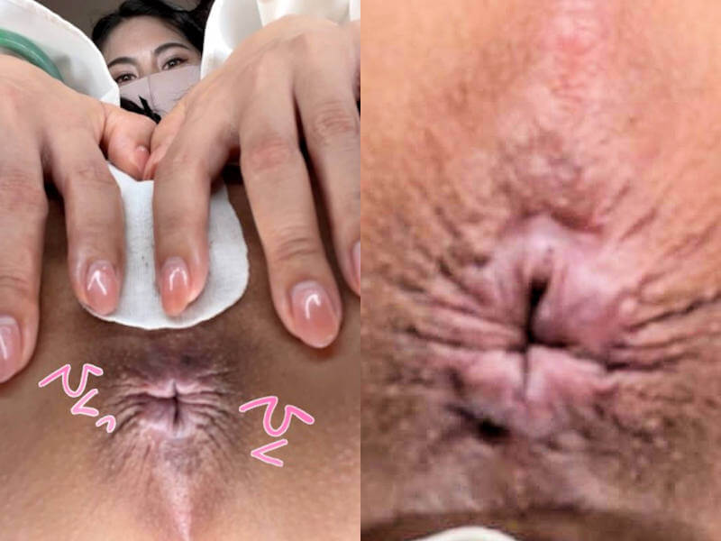 ◆お尻の穴が丸見えなエロ画像 全70枚。 変態の宴Ⅱ