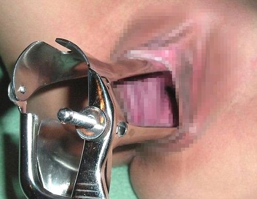 ◆【画像】マンコ×クスコ・・・くぱぁで中まで丸見えwww 変態の宴Ⅱ