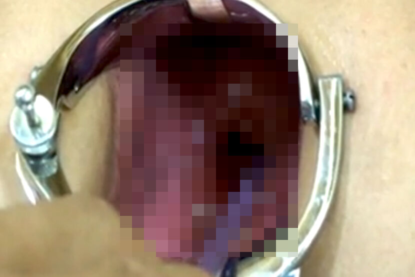 ◆【閲覧エロ注意】直腸口ぽっかり！アナルの奥の奥まで晒されるド変態妻！！ 変態の宴Ⅱ
