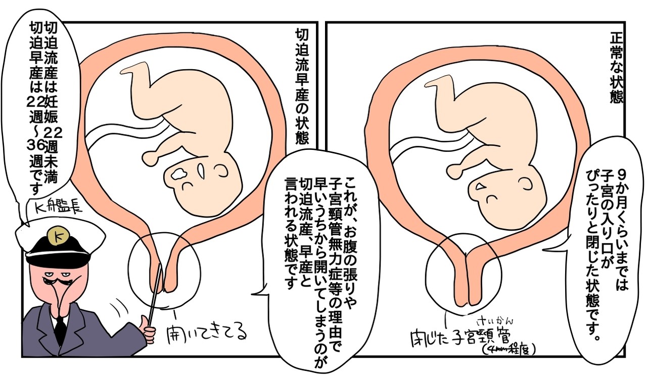 僕と切迫早産の127日戦争 トキヒロのヘタレポ Powered By ライブドアブログ 僕と切迫早産の127日戦争 トキヒロのヘタレポ Powered By ライブドアブログ