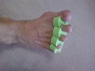 外反母趾は改善する Total Balance ﾄｰﾀﾙ ﾊﾞﾗﾝｽ