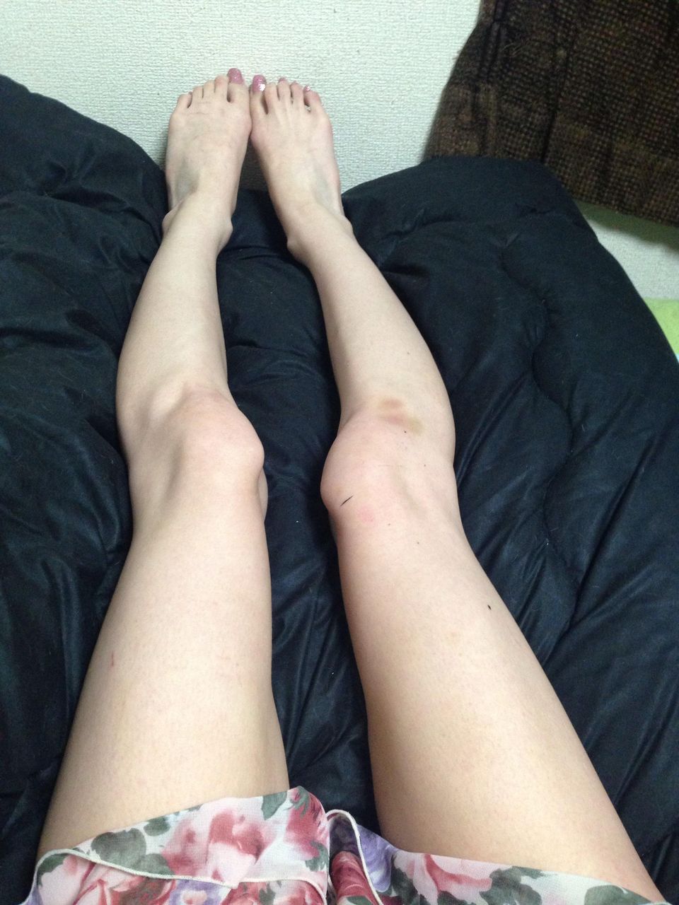 画像 女で足が汚いんだけどどうしたらいい 日々なんちゃら速 画像 女で足が汚いんだけどどうしたらいい 日々なんちゃら速