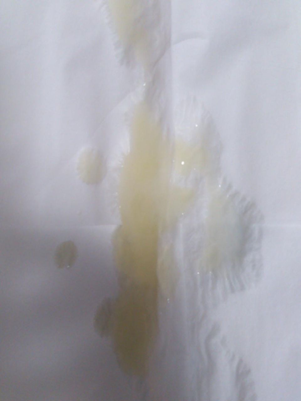 うわ 私の精液 黄色すぎ 日々なんちゃら速 うわ 私の精液 黄色すぎ 日々なんちゃら速