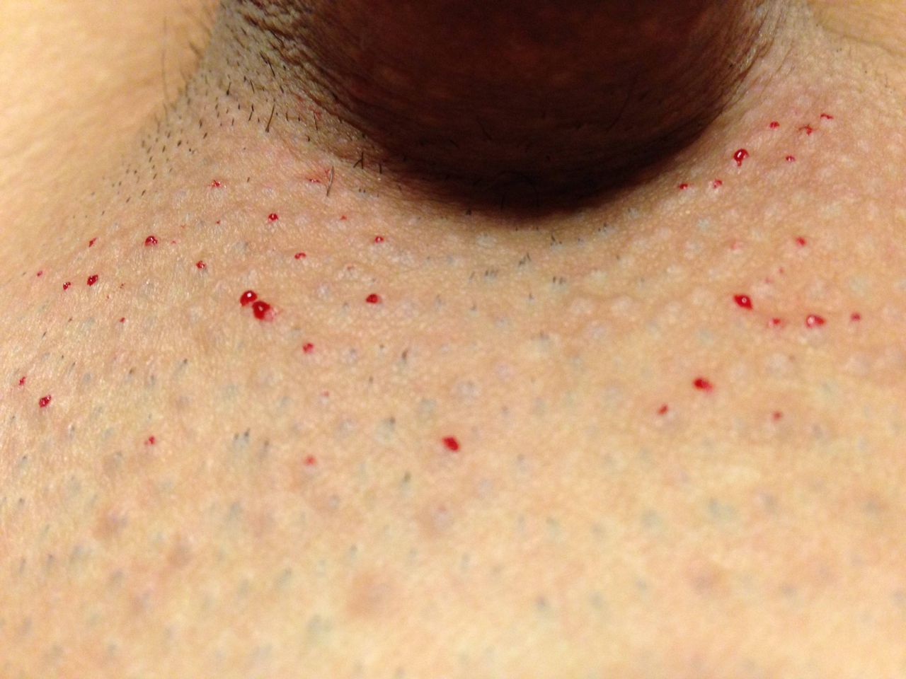 画像 チン毛剃った結果ｗｗｗｗｗｗｗ 日々なんちゃら速