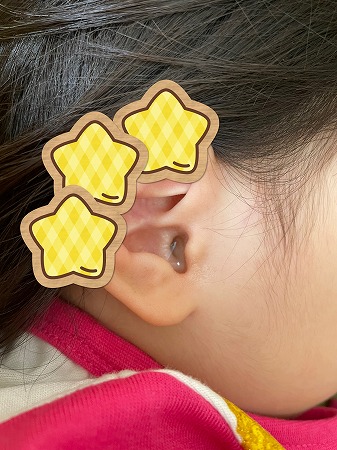 耳鼻科で驚き 子供の耳掃除どうしてる 日々のくらし手帖 Powered By ライブドアブログ 耳鼻科で驚き 子供の耳掃除どうしてる 日々のくらし手帖 Powered By ライブドアブログ