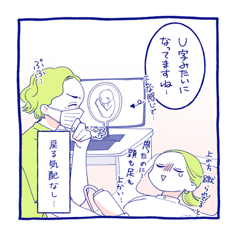 teo2-2