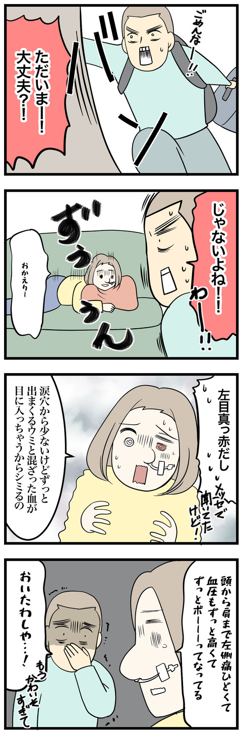 11-1