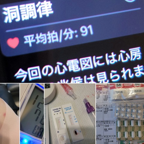 1008コロナウイルス修飾ウリジンRNAワクチンSARS-CоV-28)接種