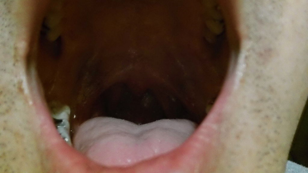 アケオメ と のどちんこ事件 ぶらぶら 散歩