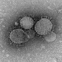 200px-MERS-CoV_electron_micrograph1