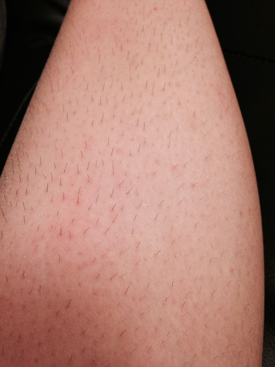 毛深い陰毛 剛毛 女性 超剛毛女の私の半生を語る : HIMAJYOのまとめ|美容・ダイエット・ファッション・エンタメ 女子のための2chまとめ