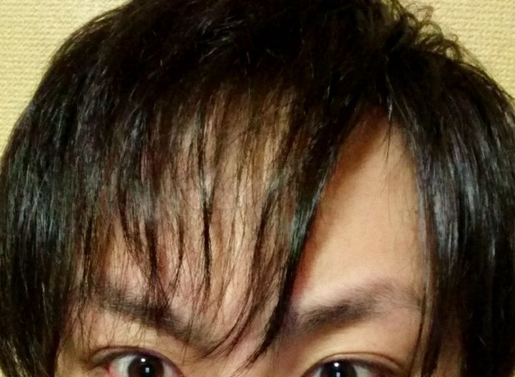 ハゲではない 前髪スカスカで理想の髪型にならない フサフサ ひまつぶし ハゲではない 前髪スカスカで理想の髪型にならない フサフサ ひまつぶし